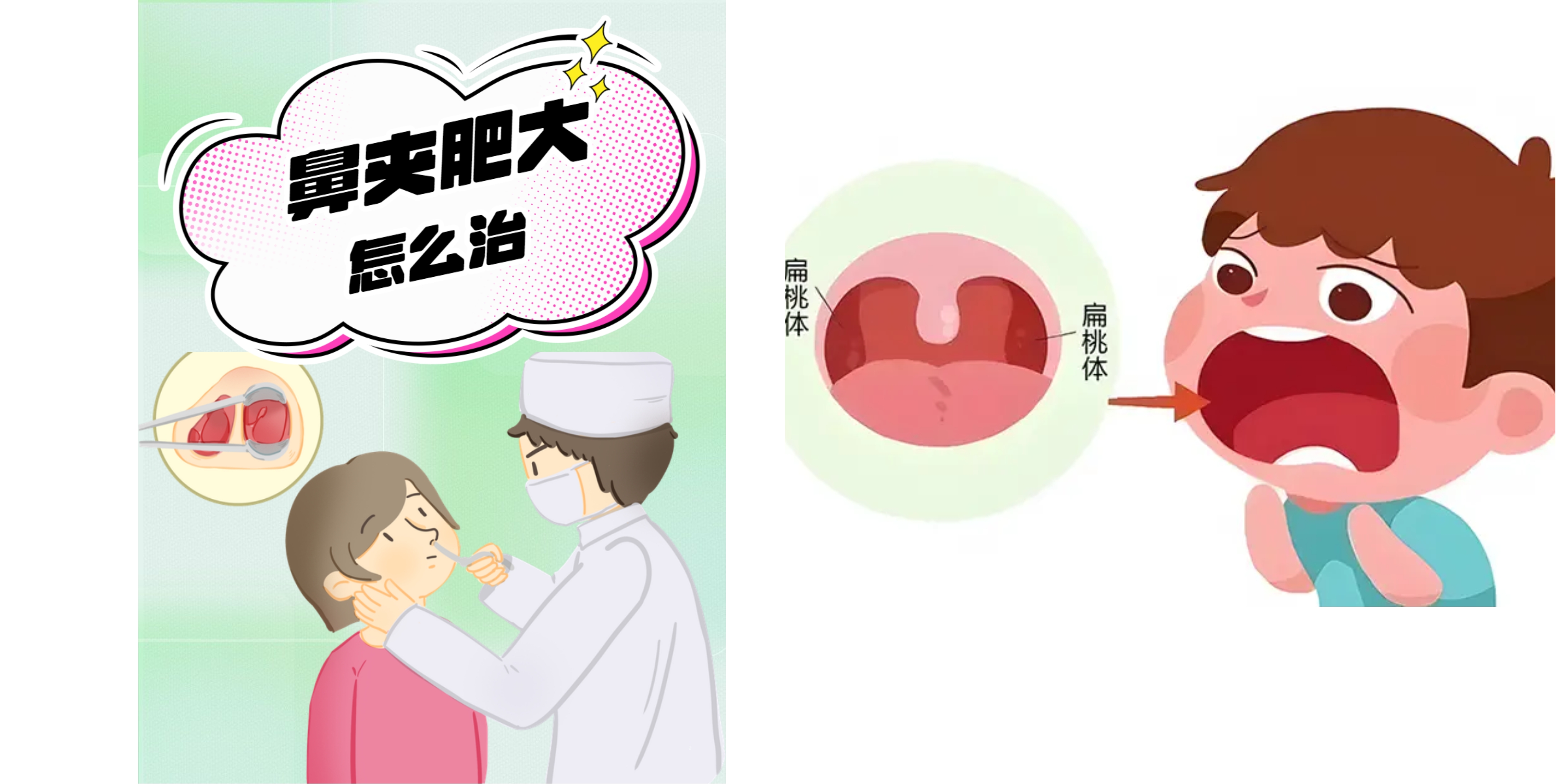 消融電極與普通電刀的區別有哪些？